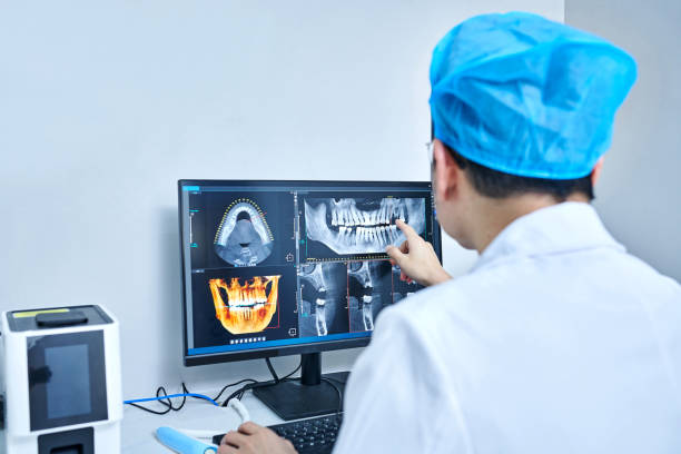 Best Emergency Root Canal Treatment in Port Charlotte, FL
